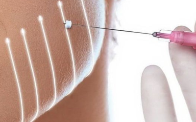 Facial Balancing Beverly Hills CA